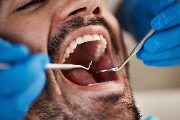 Best Dentist for Tooth Abscess  in Fkville, AL