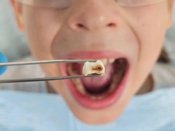 Best Tooth Pain Emergency Relief  in Fkville, AL
